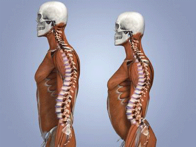 正常的腰椎骨真人图片图片