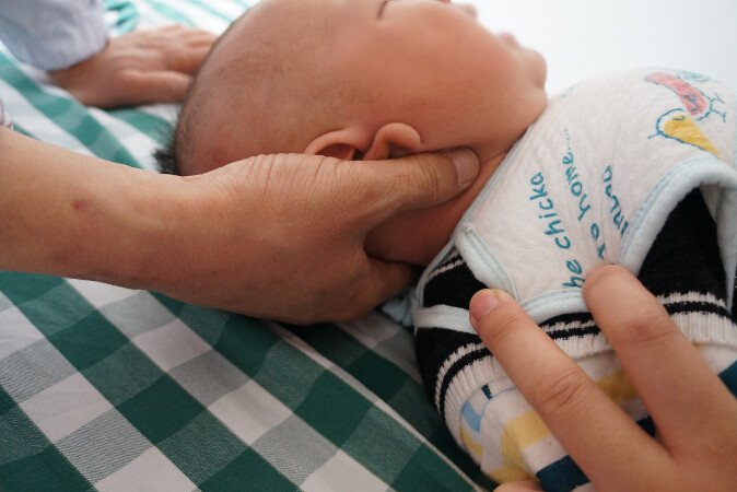 宝宝治疗痉挛性斜颈的图片