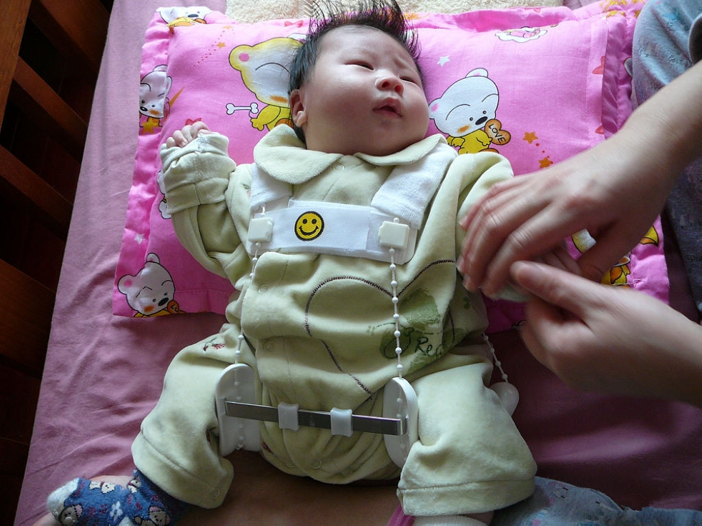 婴儿痉挛性斜颈矫正器图片