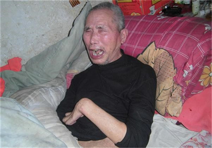 全身瘫痪的老年人图片