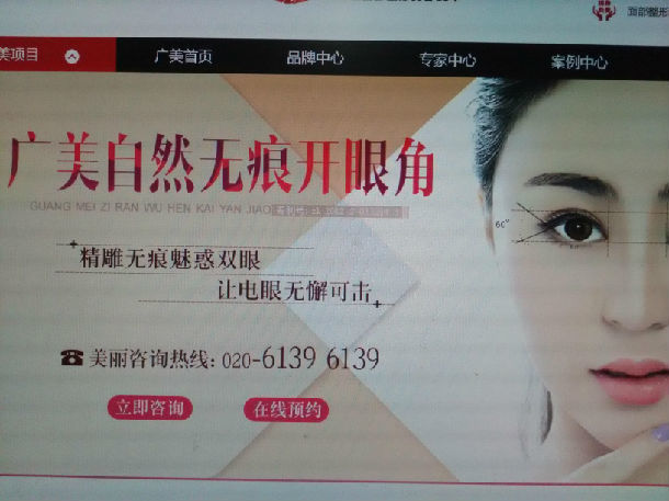 韩式无痕开眼角真有那么神奇吗?