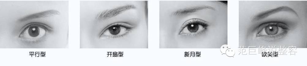 双眼皮如何分类 双眼皮有哪些类型_有来医生