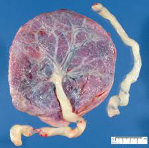 人胎盘的外形特点图片