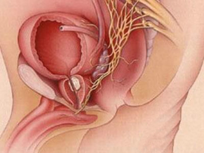 女性前庭大腺炎症状图片