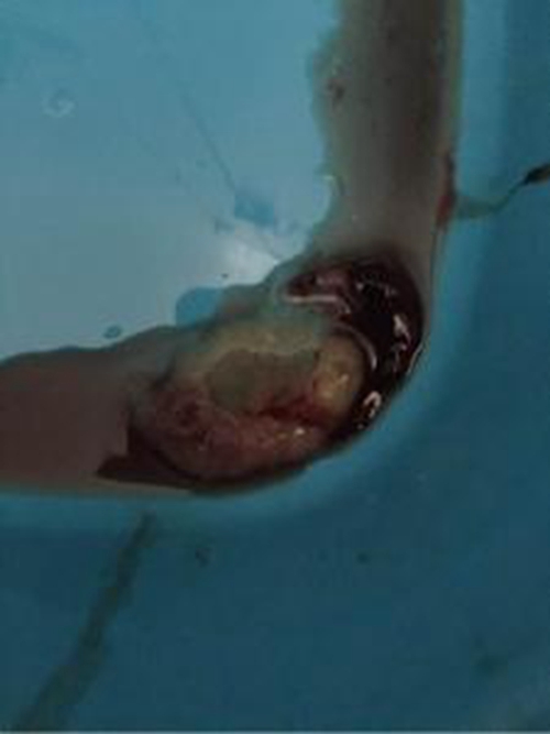 12周胚胎排出来的图片图片