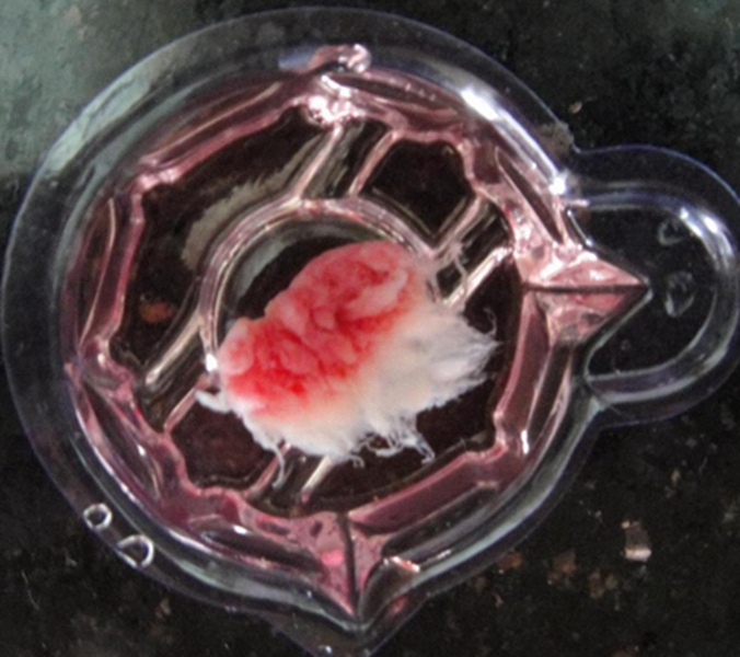 稽留流产胚胎图片图片