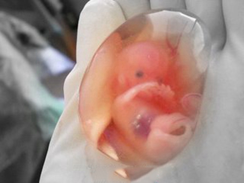 真实流产完整胚胎图片