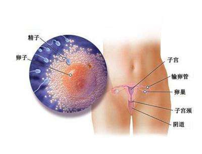 慢性宫颈炎危害图片