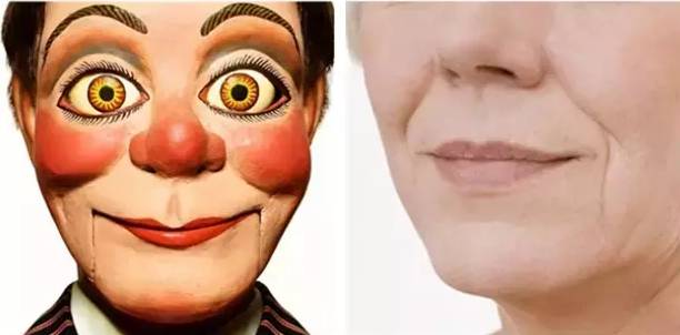 你以为忍住不笑就不长皱纹 有来医生