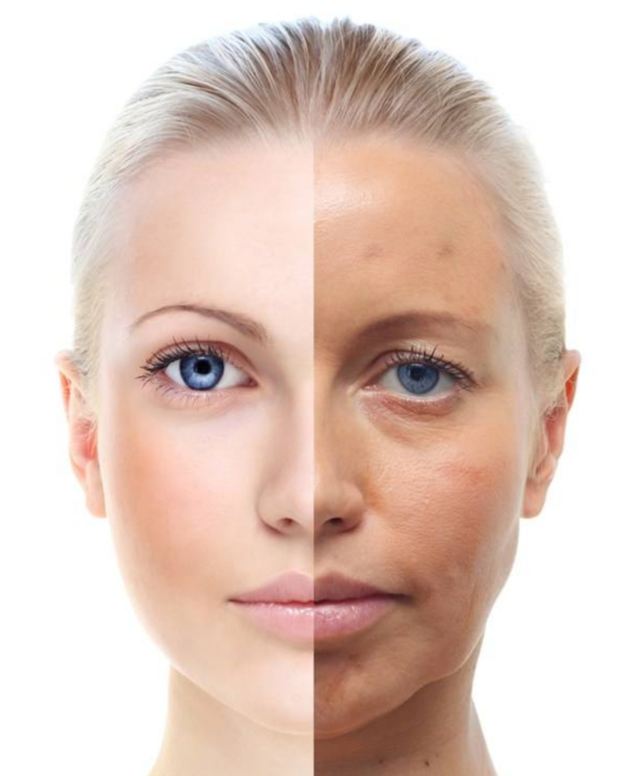 皮肤老化对比图片