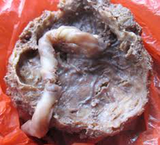 人胎盘详细的特征图片