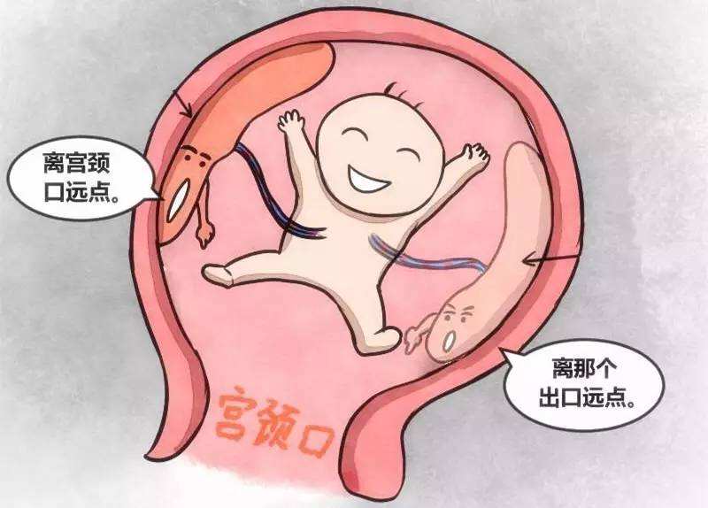 人胎盘图片漫画