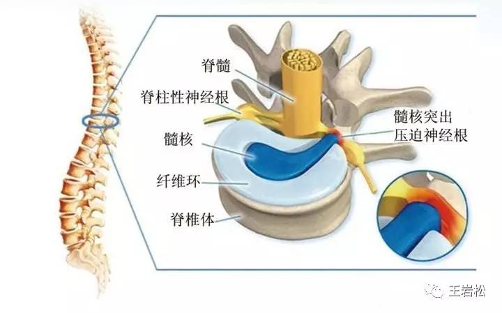 侧隐窝和椎间孔,侧隐窝椎间孔,椎间孔和椎孔区别(第10页)_大山谷图库