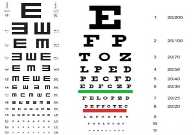 儿童视力表对应近视度数表