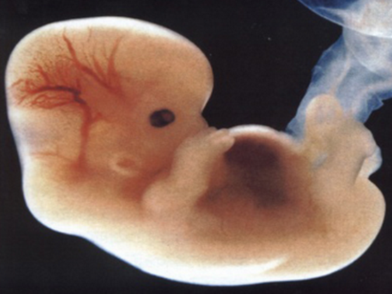 七十天胎儿图片真实图片