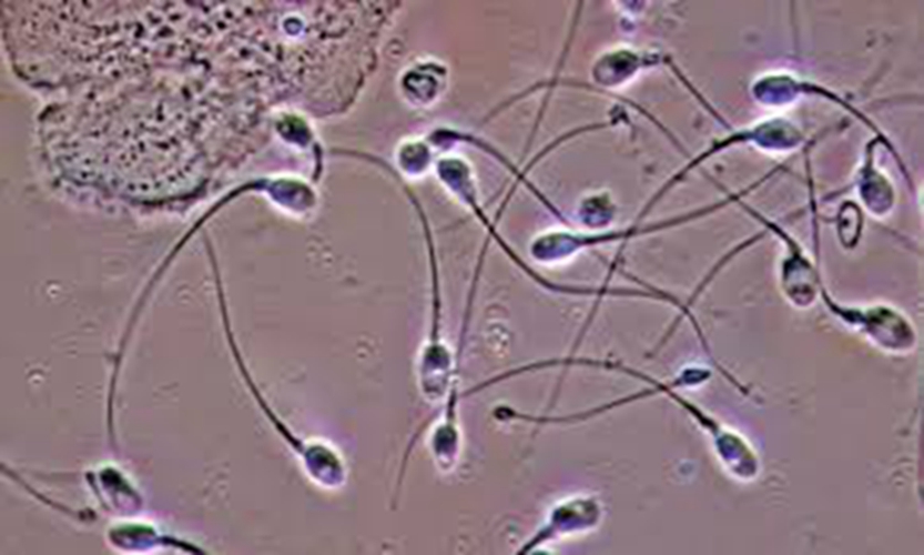 精液的精子的微观的图片