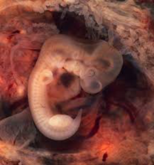 6周胎儿药流下来图图片