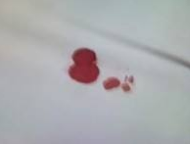 处女膜的落红图片