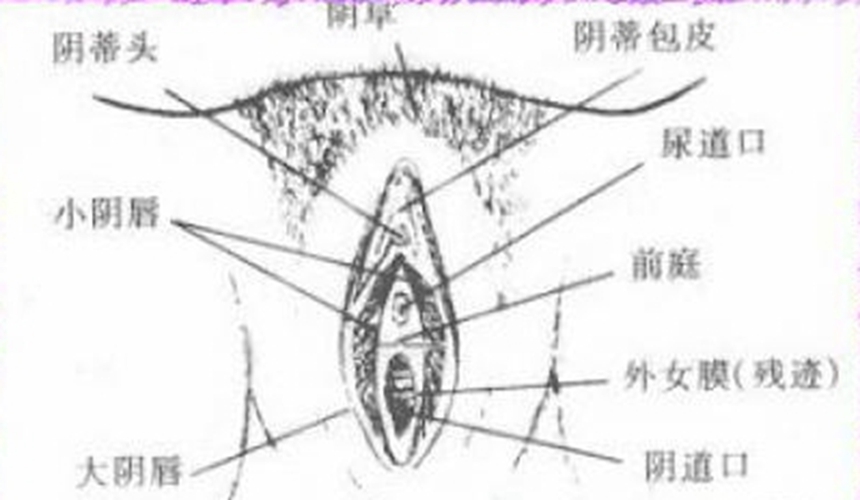 外阴溃疡的外部症状图片