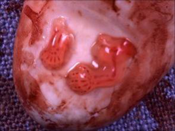 八周药流胚胎图片图片