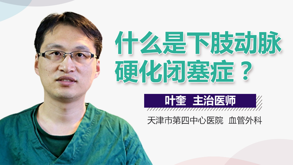 什么是动脉硬化有哪些表现 ooYBAFj0KFaANC7-AAAy8Ebx9Co66.jpeg