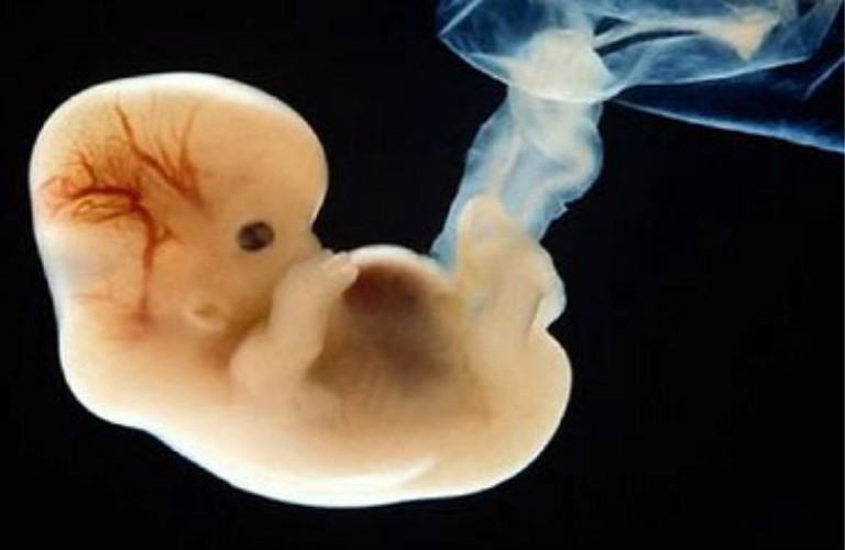胚胎不发育原因