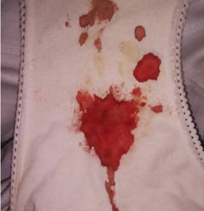 女人月经流血图片