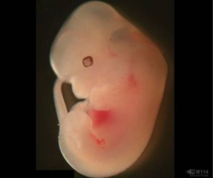 胚胎图