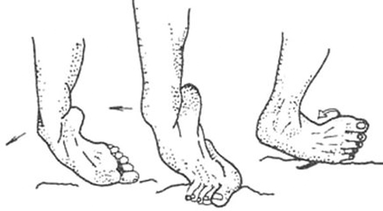 膝关节韧带损伤 (5)