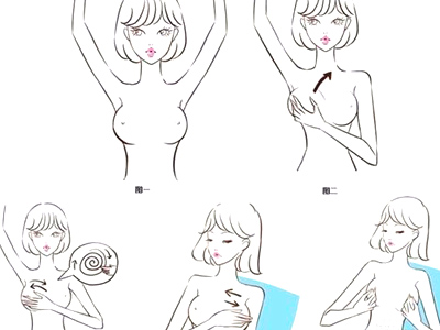 乳腺增生按摩治疗方法 (4)