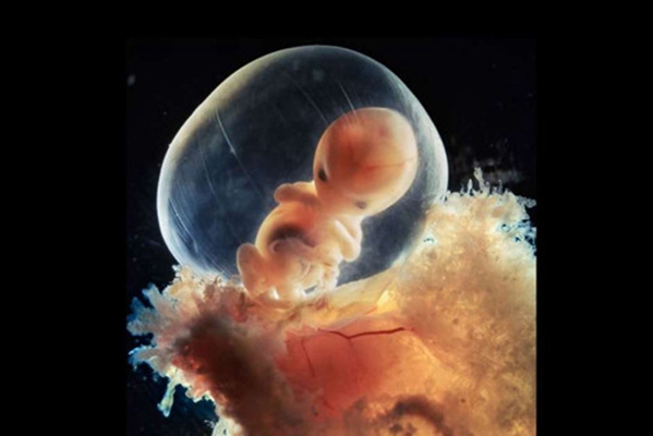 胎儿在肚子里的姿势 (29)