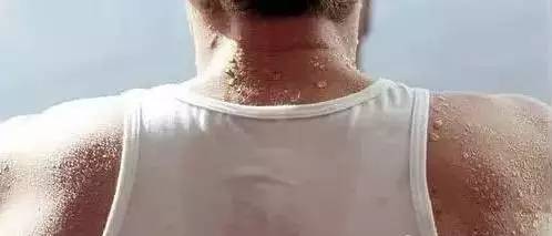 7,背部出汗=阴阳虚弱,极度疲劳