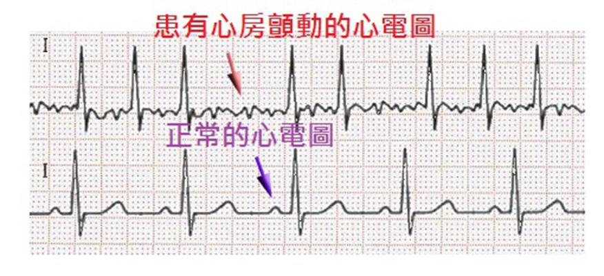 心电图异常 (42)