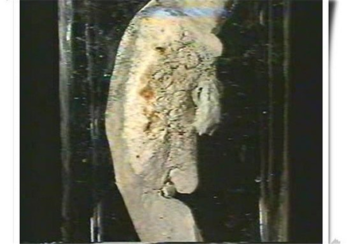 阿米巴痢疾标本图片