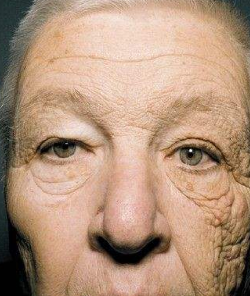 皮肤老化老年人的图片