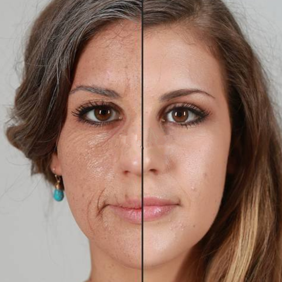 皮肤老化妆前对比图片