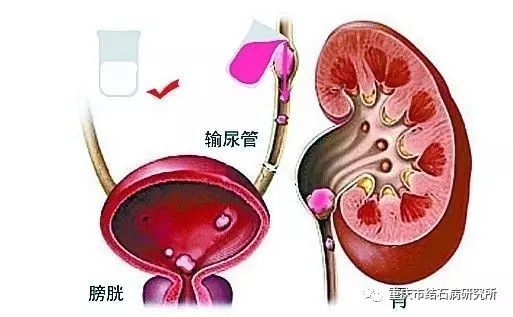 出血性膀胱炎图片
