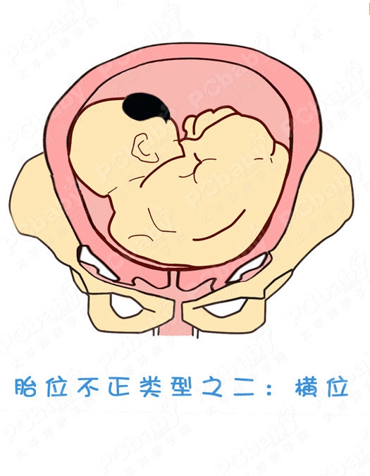 十字法表示胎方位图片
