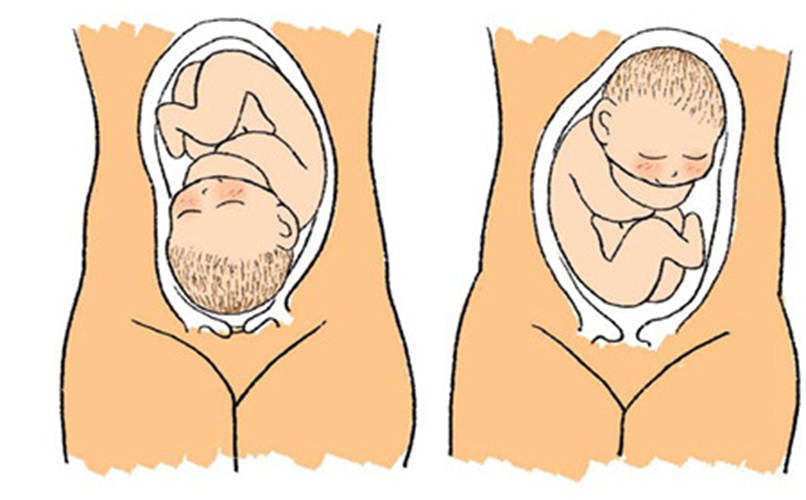 胎方位用十字图表示图片