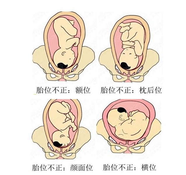 怀孕1一9月胎位变化图图片