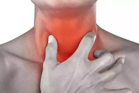 咽喉癌的早期症状及表现 (57)