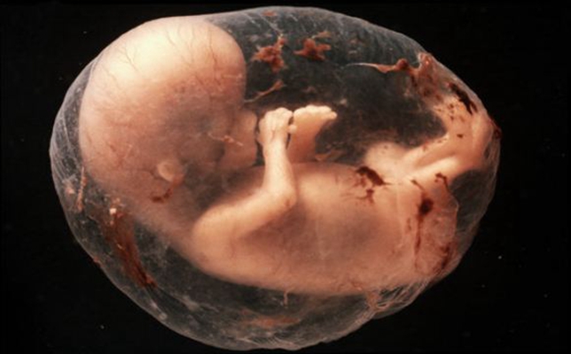 怀孕53天真实胎儿图图片