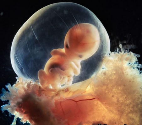 66天的胎儿发育图片图片