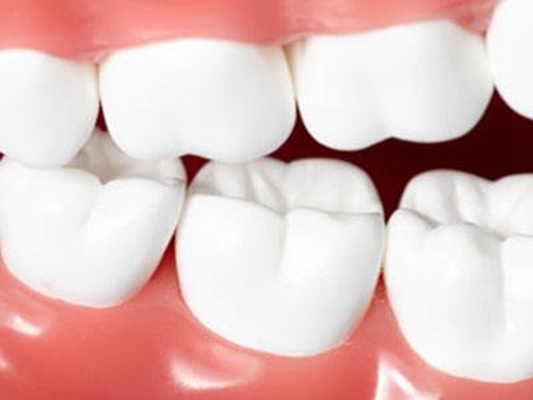 牙齿美白图 (3)