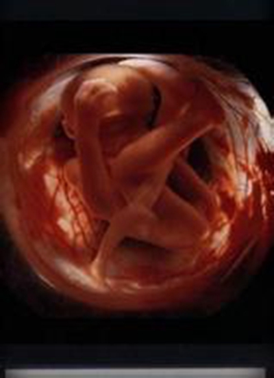 胎儿发育图 (80)