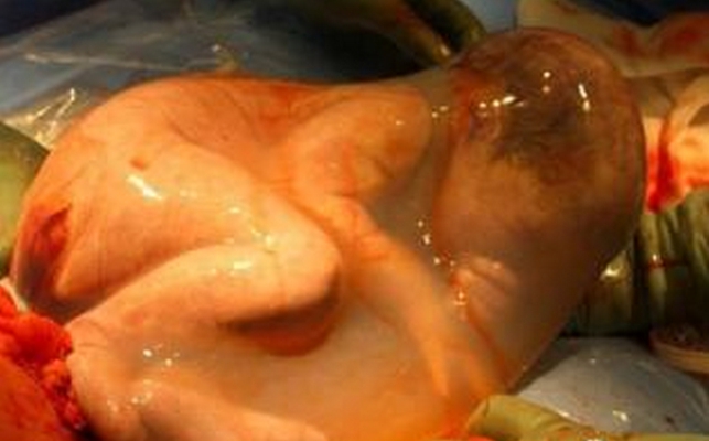 胎儿发育图 (86)