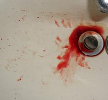 洗手池吐血图片图片