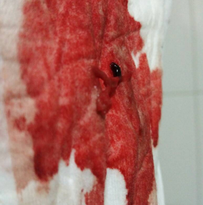 月经正常经血图片高清图片