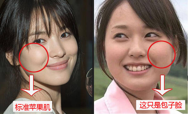 苹果肌or高颧骨傻傻分不清楚