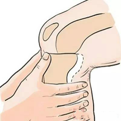 膝关节韧带损伤 (1)